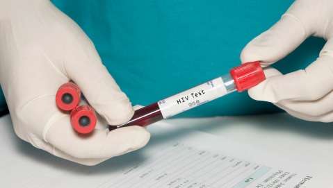 Aids: in Europa e Asia i nuovi casi aumentati dell’80% in 10 anni