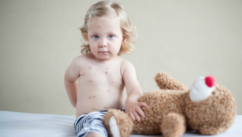 Ecco perchè il vaccino contro il morbillo ci protegge anche da altro