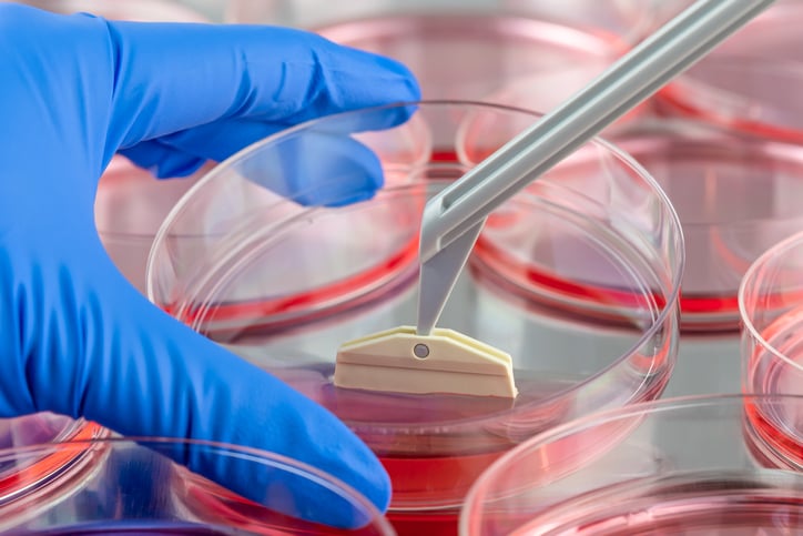 Dieta ipoglicemica e metformina nella lotta al cancro