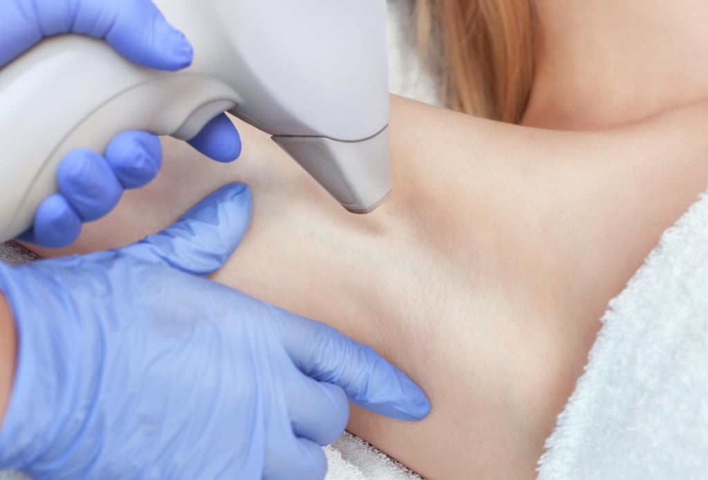 Una paziente oncologica può usare l&#8217;epilazione laser?