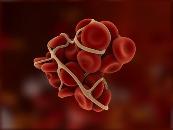 L&#8217;esame del sangue che evita l&#8217;infarto