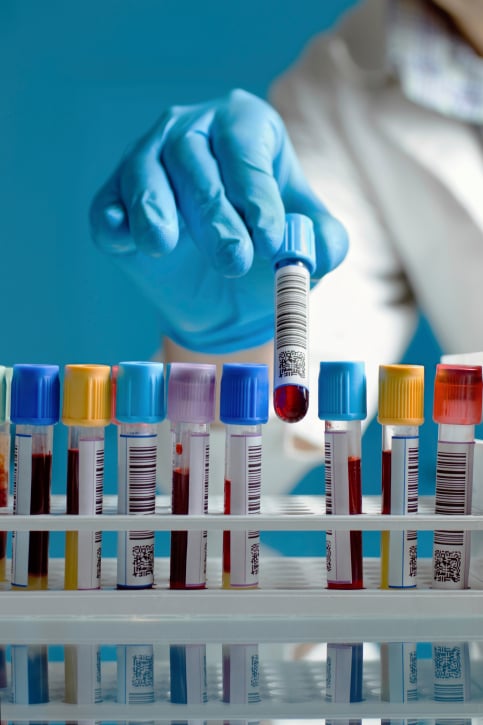 Il segreto del diabete è nascosto nel fegato