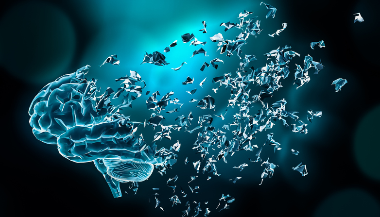 Così si cura l&#8217;Alzheimer