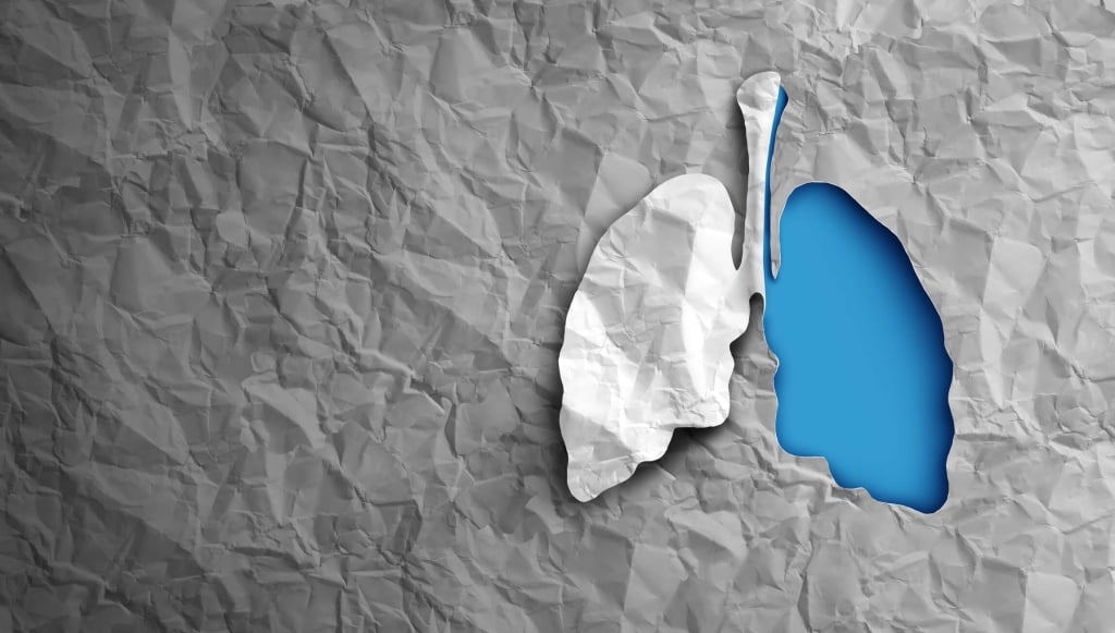 Tumore al polmone: perché si fanno pochi screening?