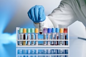 Tumore del sangue Fondazione Veronesi