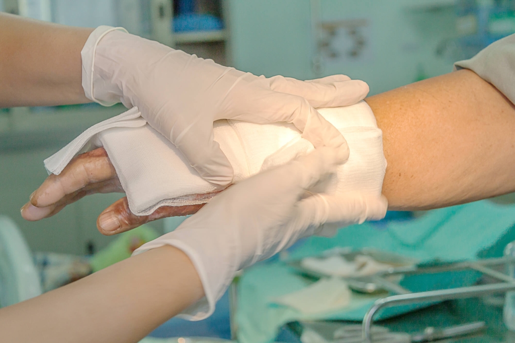 Più di un trauma: parliamo di malattia da ustione