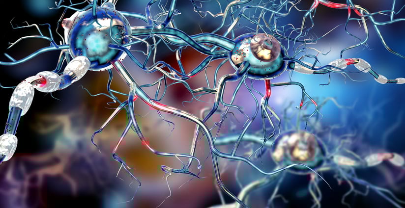 Sclerosi multipla: per le forme più gravi arriva Ocrelizumab