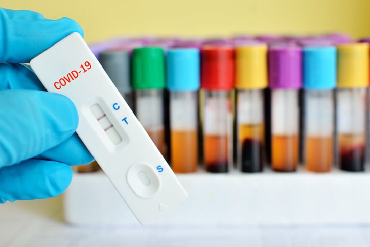 Test antigenici (Covid-19)