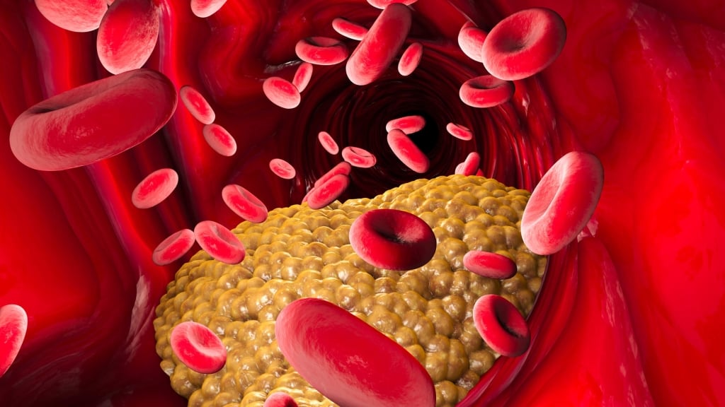 Colesterolo: ecco come interpretare correttamente i valori degli esami del sangue