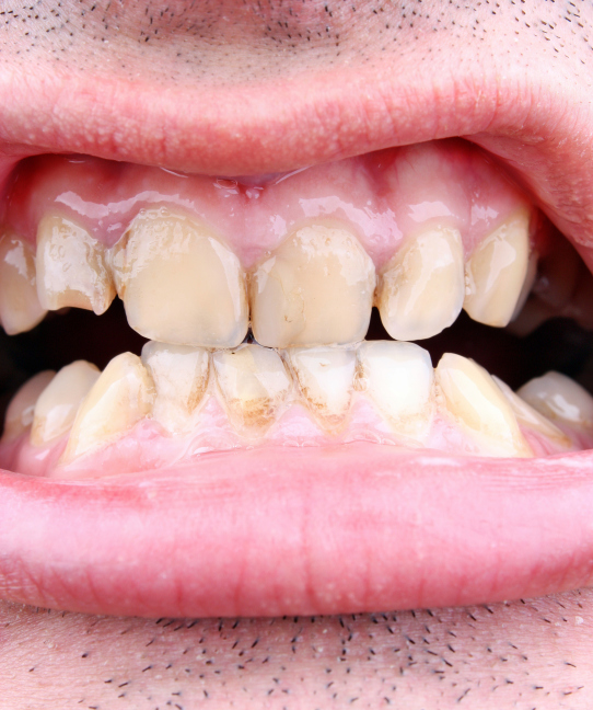 ThinkstockPhotos-467352559