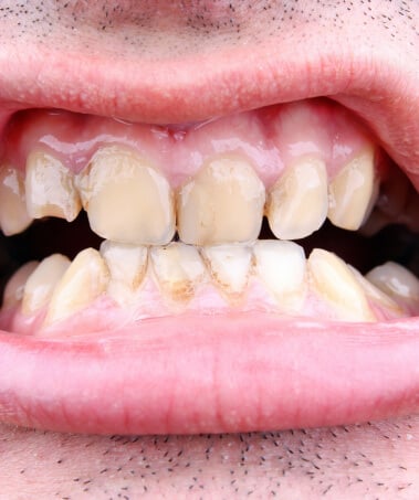 ThinkstockPhotos-467352559