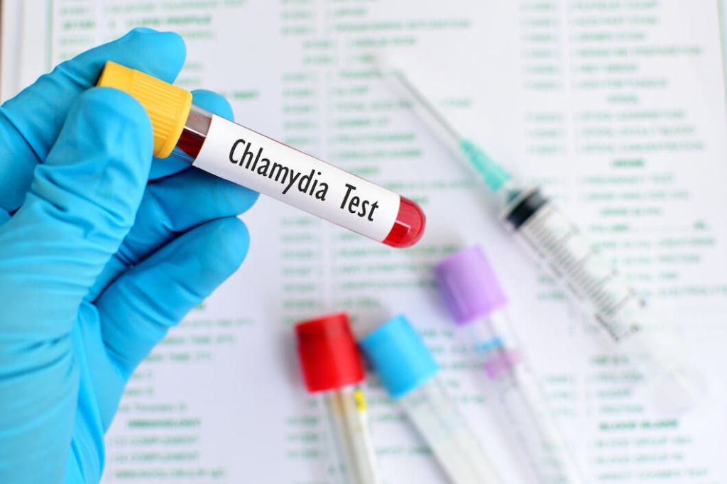 Clamidia