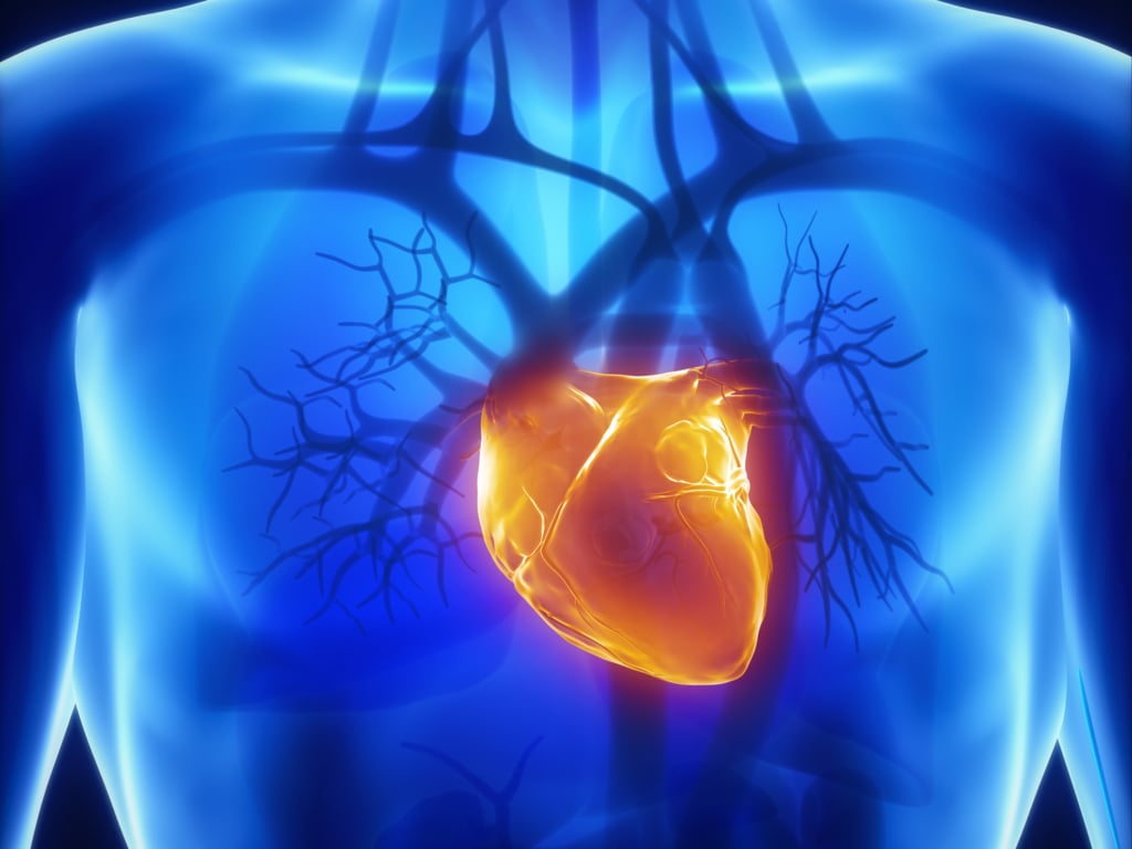 Infarto del miocardio