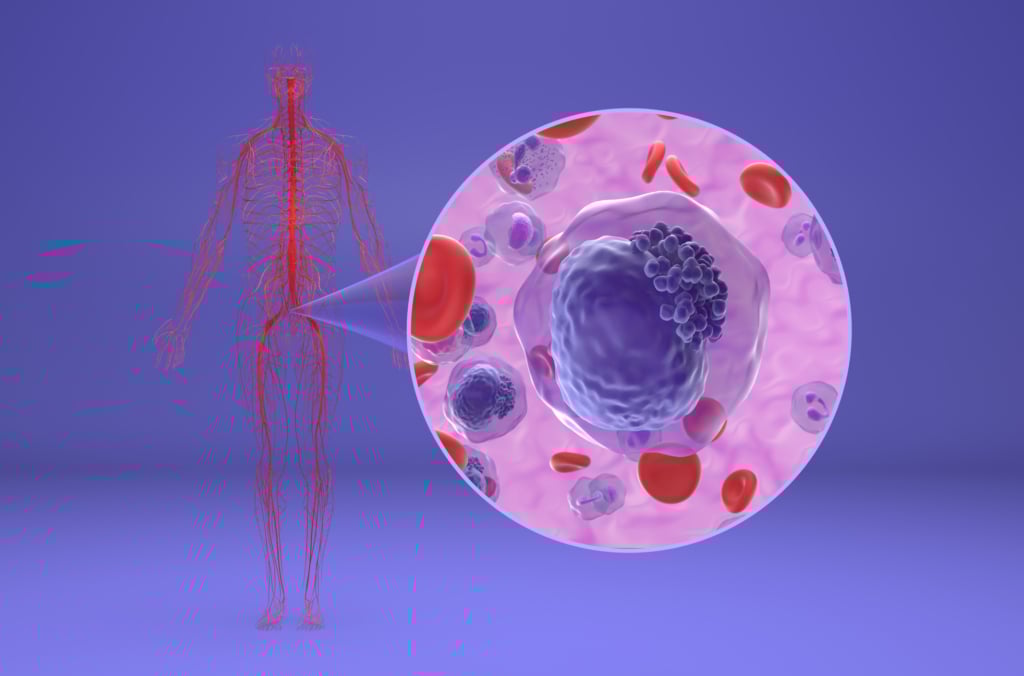 Cellula con leucemia mieloide cronica