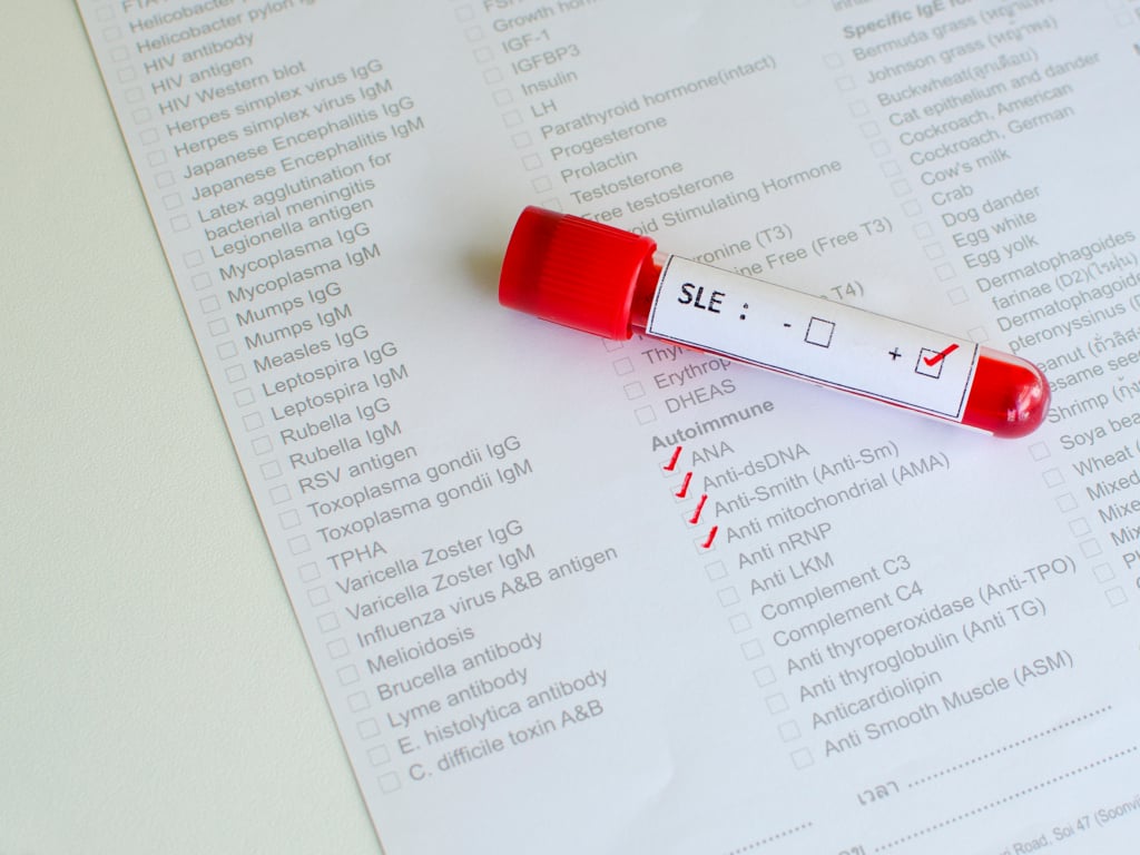 Lupus eritematoso sistemico (LES)
