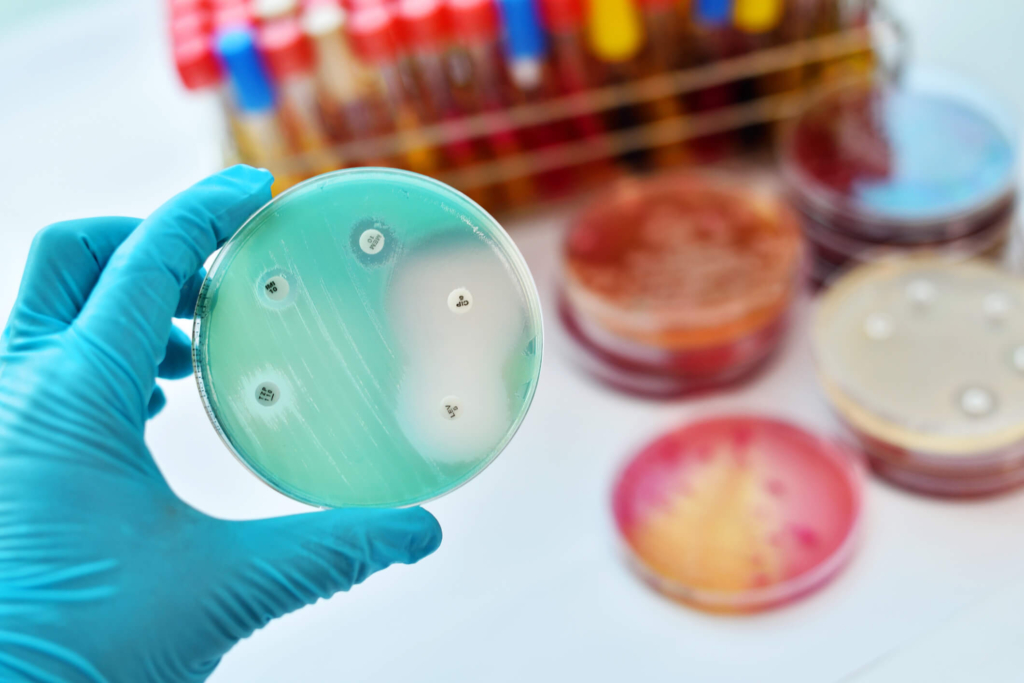 resistenzaantibioticigettyimages-692560202