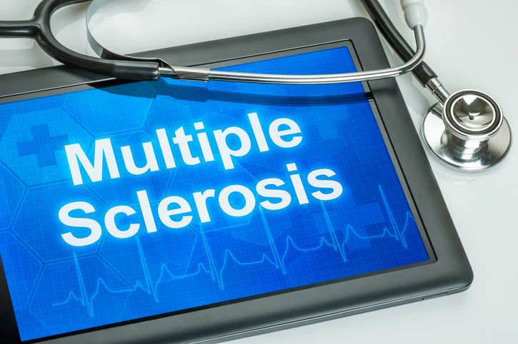 Sclerosi multipla