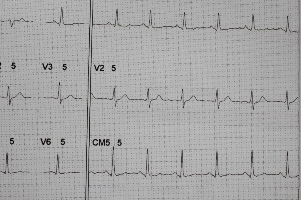 thinkstockphotos-647053992