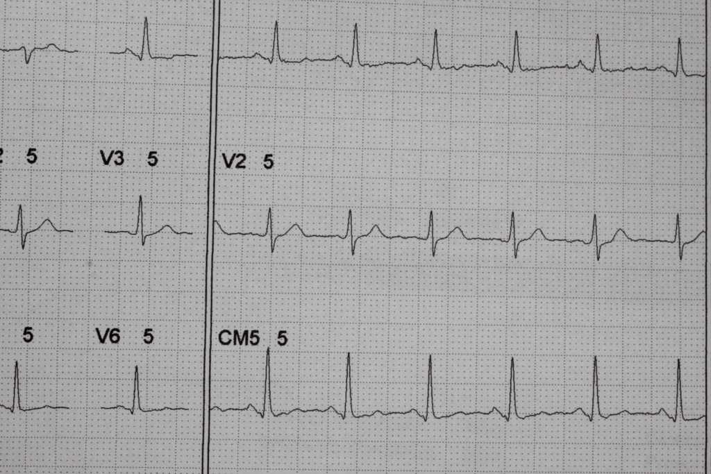 thinkstockphotos-647053992