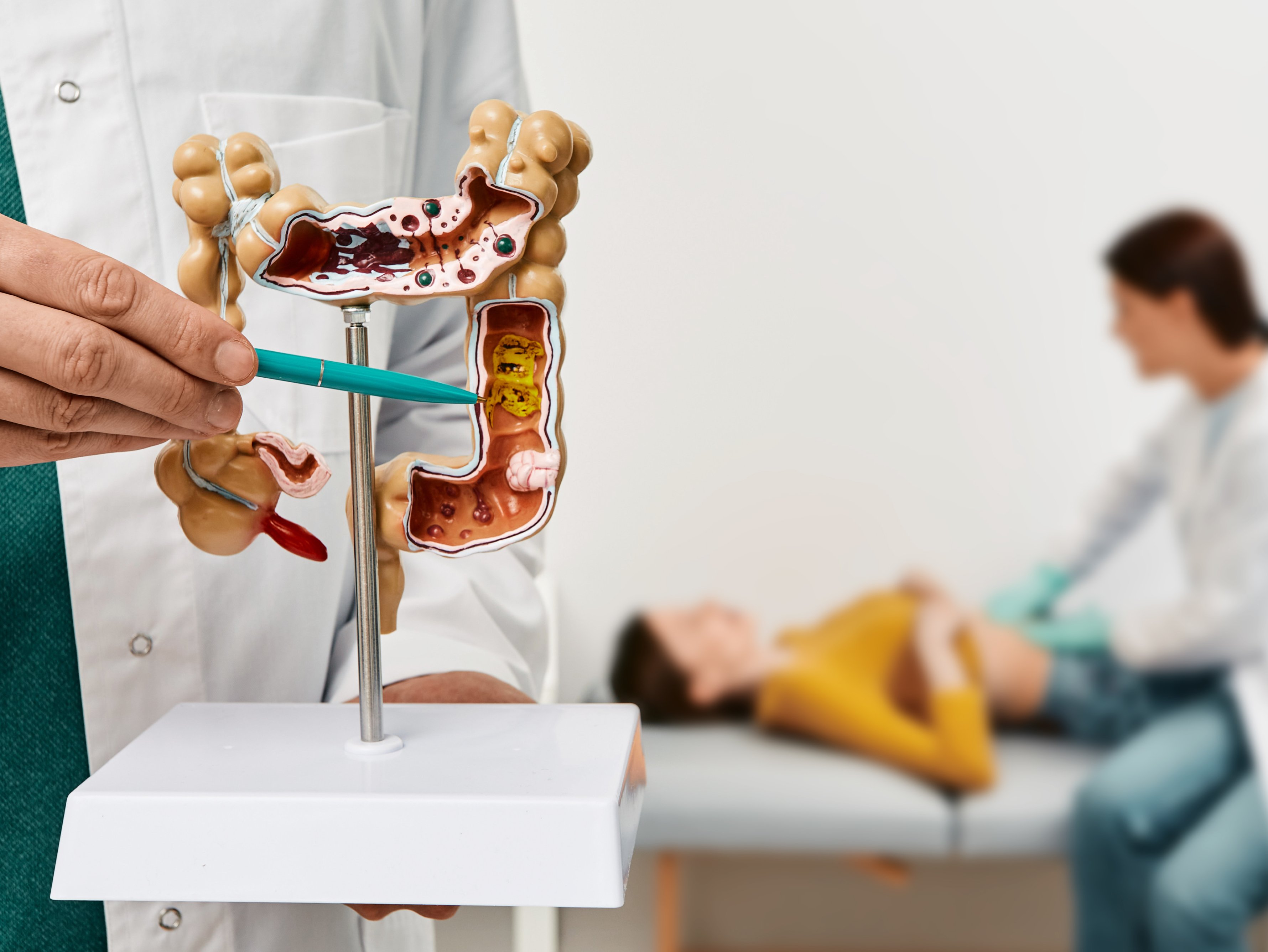Che cosa è il tumore del colon retto