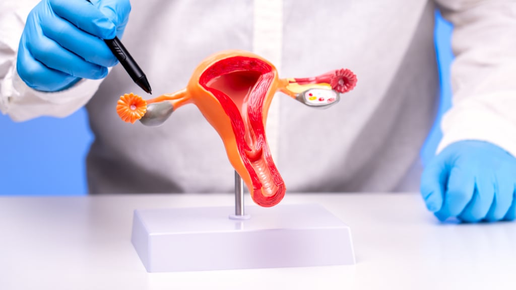 Medico illustra la tecnica dell'Isterectomia e salpingectomia