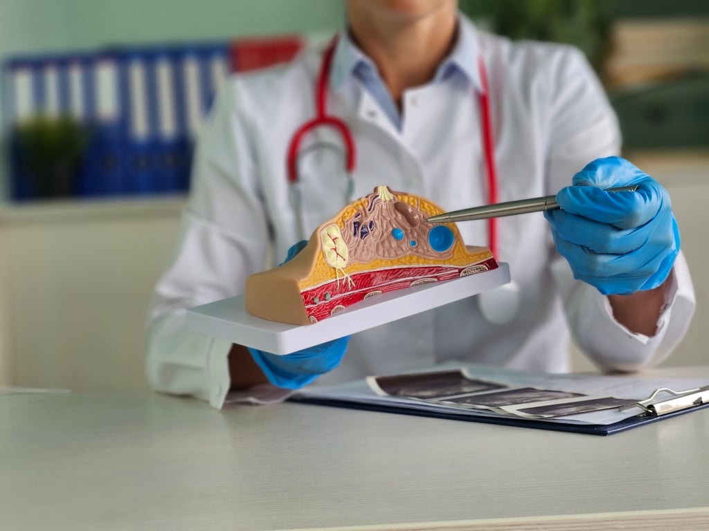 Tumore al seno HER2-positivo